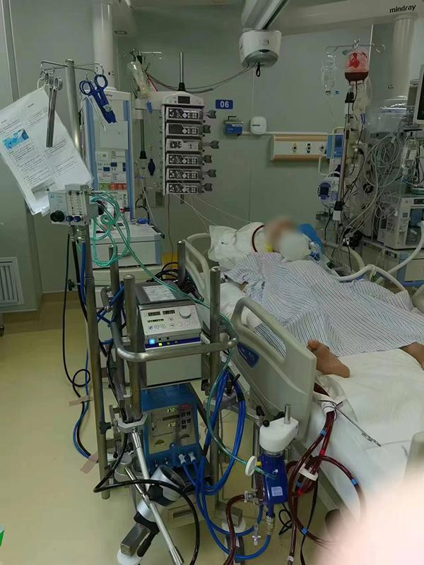 深圳一七旬老人因鹦鹉热致呼吸衰竭，人工肺挽救其生命
