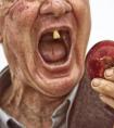 老人缺牙越厉害越容易老年痴呆